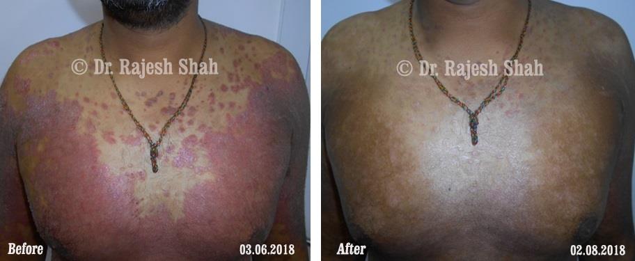 lifeforce homeopathy case-photos